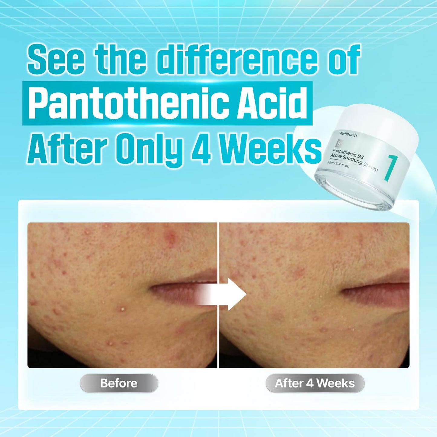 numbuzin No.1 Pantothenic B5 Active Soothing Cream application
