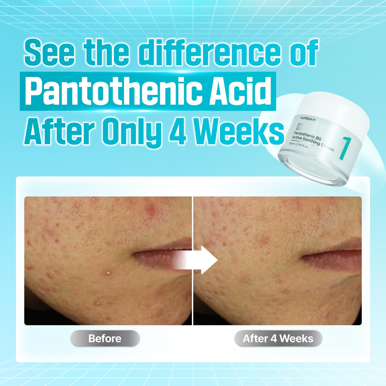 numbuzin No.1 Pantothenic B5 Active Soothing Cream application